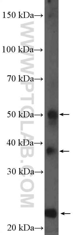 Western Blot (WB) analysis of mouse liver tissue using HFE2 Polyclonal antibody (11758-1-AP)