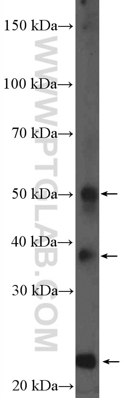 WB analysis of mouse liver using 11758-1-AP