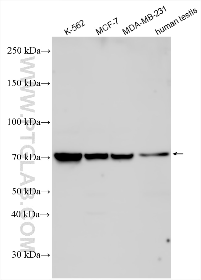 WB analysis using 33841-1-AP (same clone as 33841-1-PBS) Western Blot (WB) analysis of various lysates using HFM1 Polyclonal antibody (33841-1-AP)