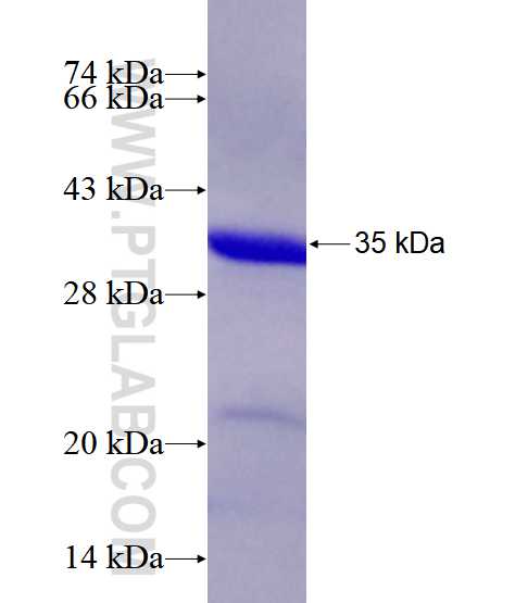 HFM1 fusion protein Ag25862 SDS-PAGE