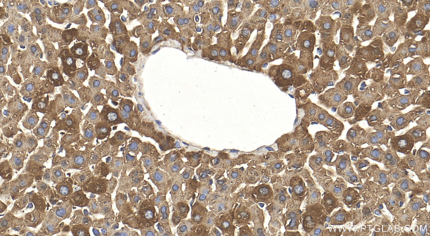 Immunohistochemistry (IHC) staining of mouse liver tissue using HGD Polyclonal antibody (16465-1-AP)