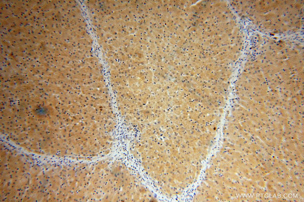 Immunohistochemistry (IHC) staining of human liver tissue using HGD Polyclonal antibody (16465-1-AP)