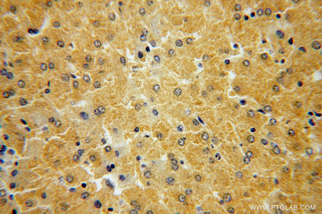 Immunohistochemistry (IHC) staining of human liver tissue using HGD Polyclonal antibody (16465-1-AP)