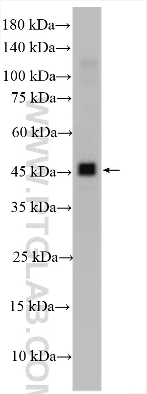 Western Blot (WB) analysis of various lysates using HGD Polyclonal antibody (16465-1-AP)