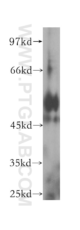 Western Blot (WB) analysis of HeLa cells using HGD Polyclonal antibody (16465-1-AP)