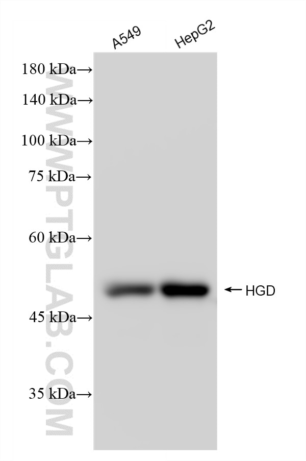 Western Blot (WB) analysis of various lysates using HGD Recombinant antibody (84931-5-RR)