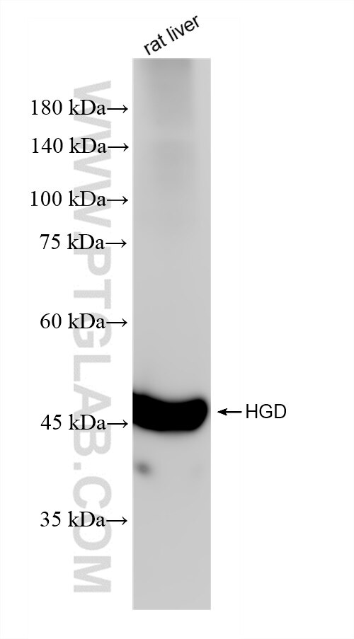 Western Blot (WB) analysis of various lysates using HGD Recombinant antibody (84931-5-RR)