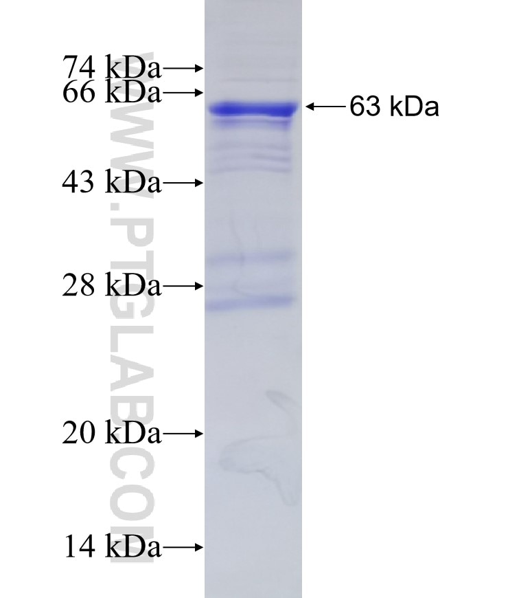 HGD fusion protein Ag9544 SDS-PAGE