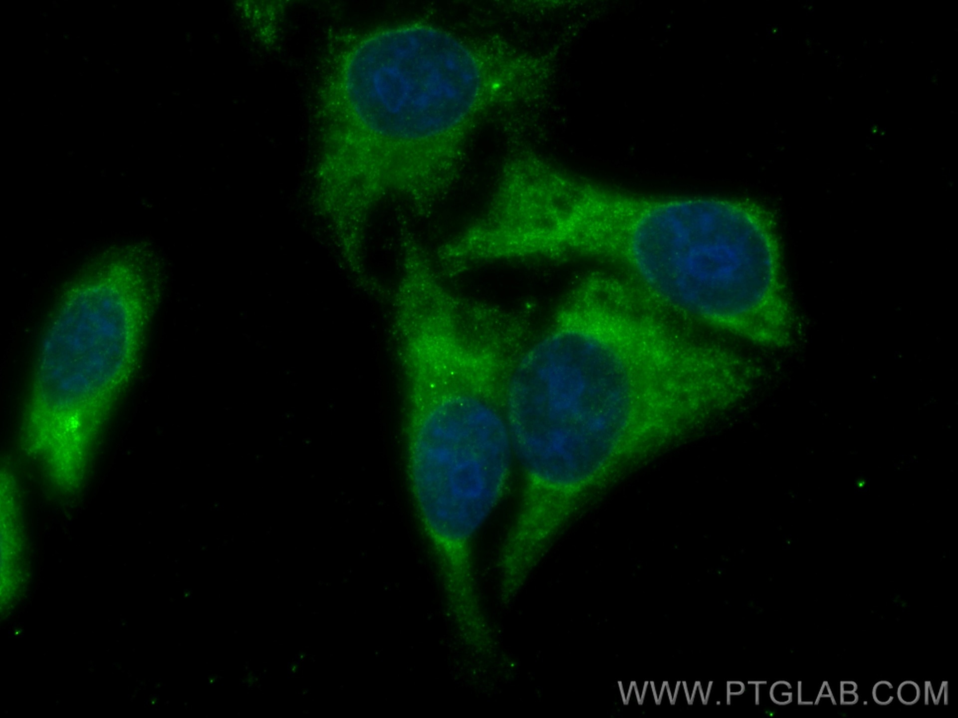 Immunofluorescence (IF) / fluorescent staining of HepG2 cells using HGF Alpha Polyclonal antibody (26881-1-AP)