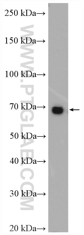 Western Blot (WB) analysis of HEK-293T cells using HGF Alpha Polyclonal antibody (26881-1-AP)