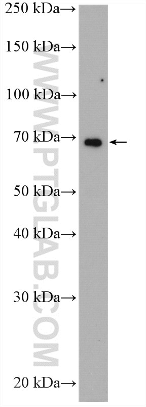 Western Blot (WB) analysis of human placenta tissue using HGF Alpha Polyclonal antibody (26881-1-AP)