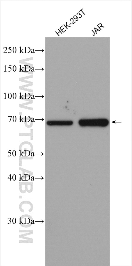 Western Blot (WB) analysis of various lysates using HGF Alpha Polyclonal antibody (26881-1-AP)