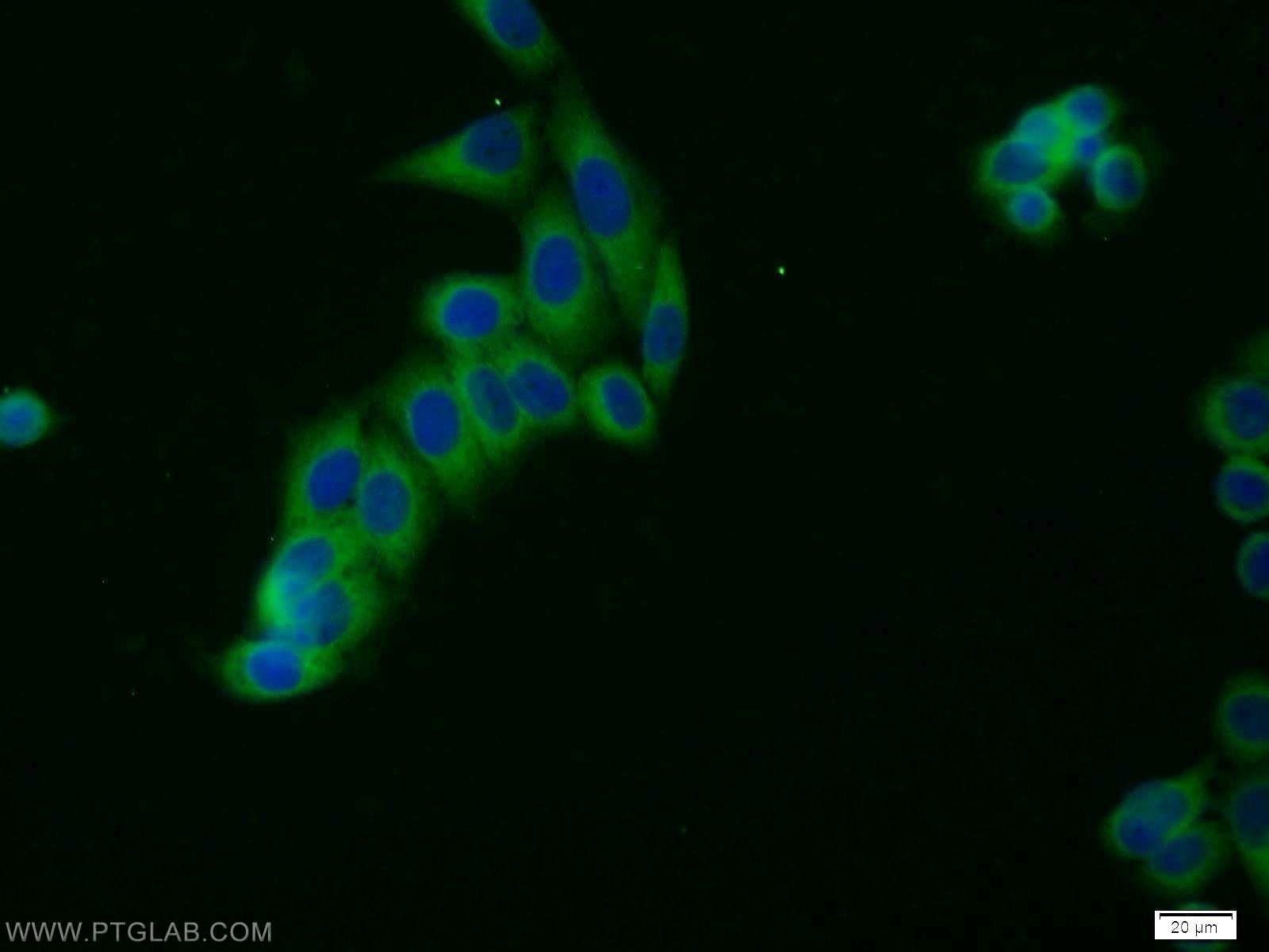 HGS Polyclonal antibody