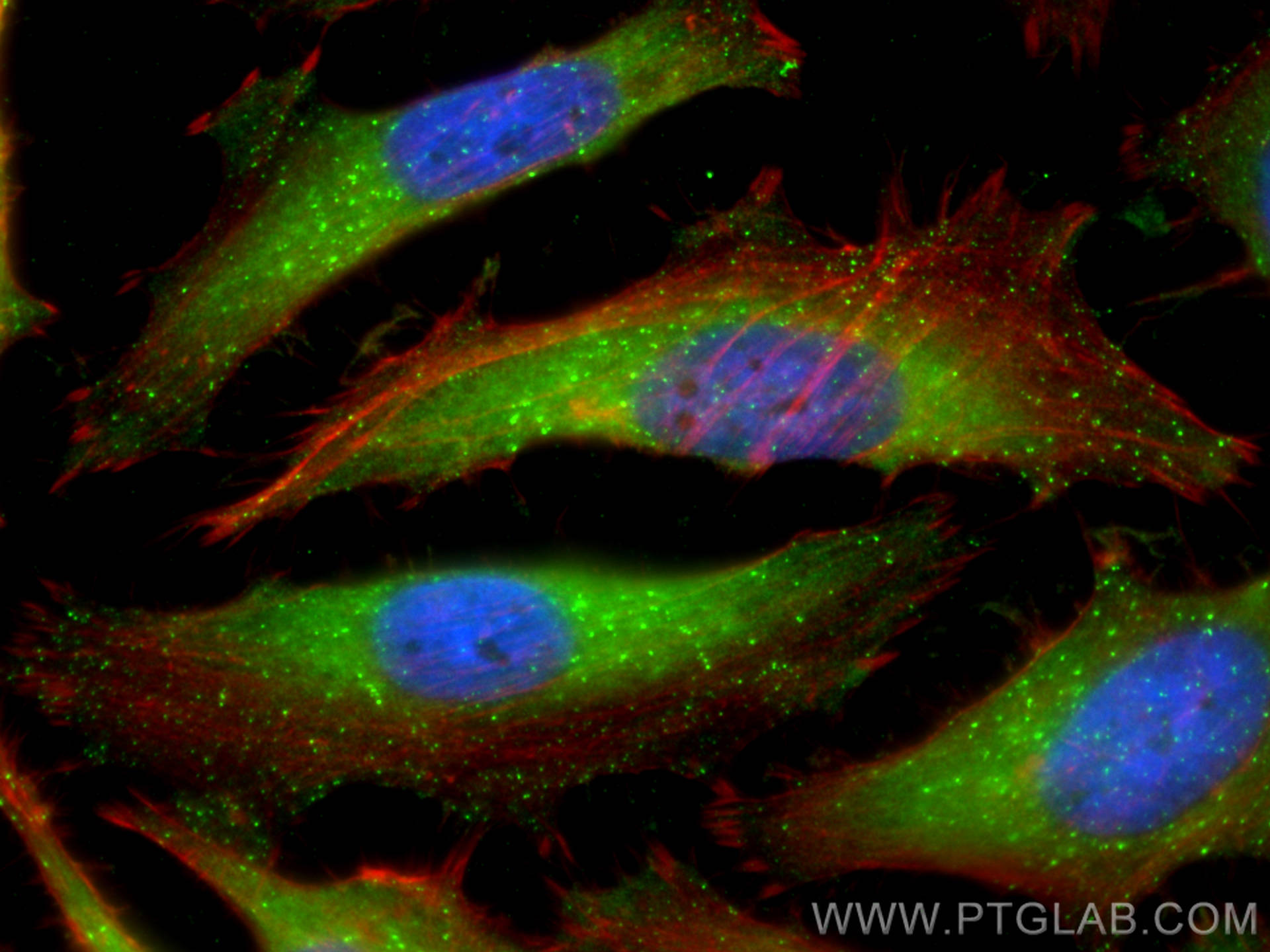 Immunofluorescence (IF) / fluorescent staining of HeLa cells using HGS Polyclonal antibody (10390-1-AP)
