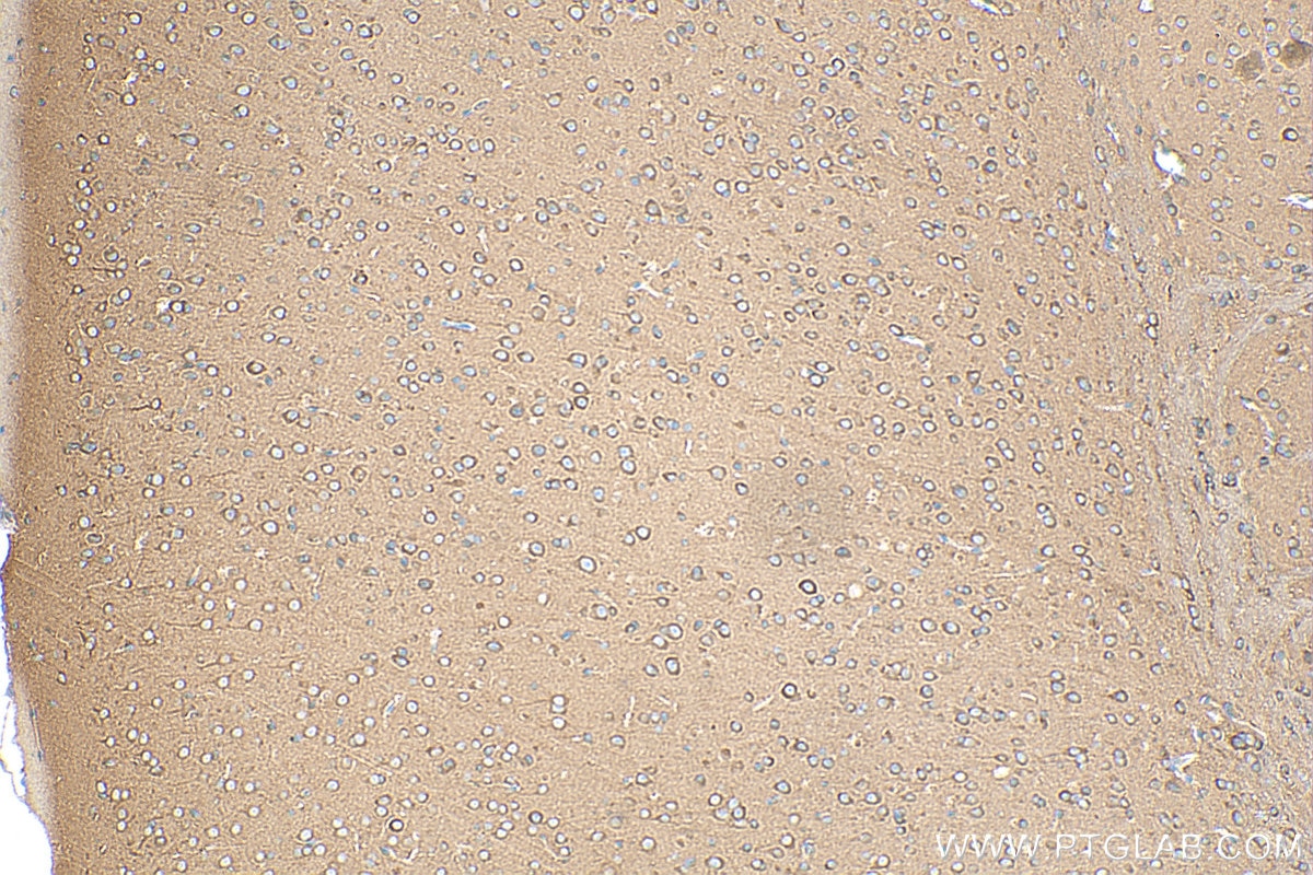 Immunohistochemistry (IHC) staining of mouse brain tissue using HGS Polyclonal antibody (10390-1-AP)