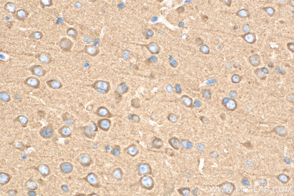 Immunohistochemistry (IHC) staining of mouse brain tissue using HGS Polyclonal antibody (10390-1-AP)