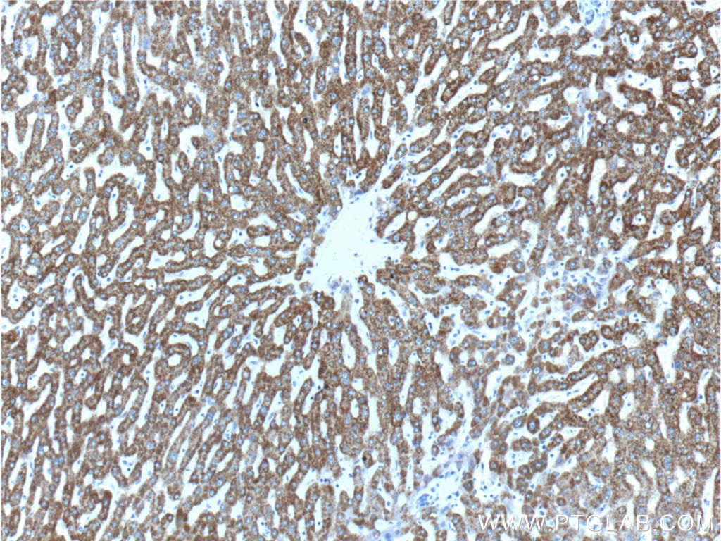 Immunohistochemistry (IHC) staining of human liver tissue using HGS Polyclonal antibody (10390-1-AP)