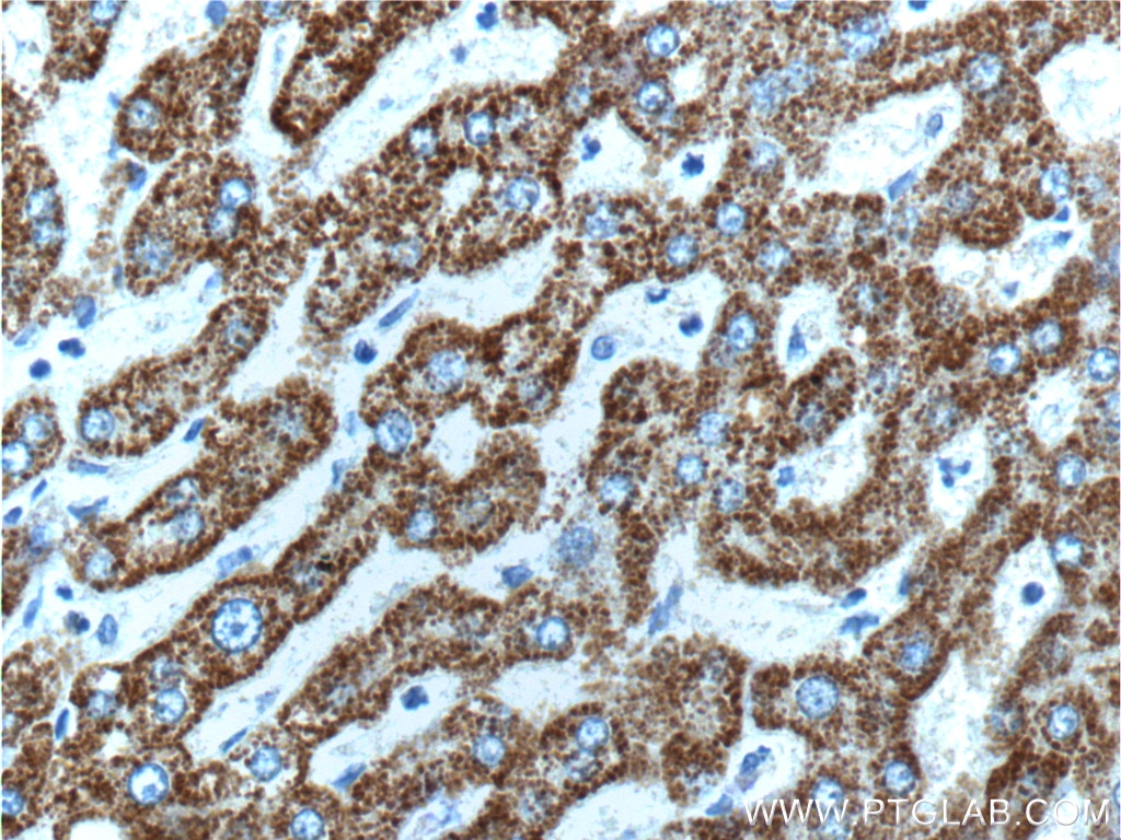 Immunohistochemistry (IHC) staining of human liver tissue using HGS Polyclonal antibody (10390-1-AP)