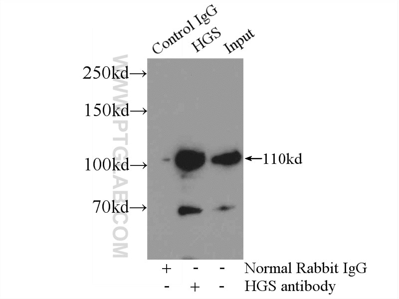 Immunoprecipitation (IP) experiment of mouse brain tissue using HGS Polyclonal antibody (10390-1-AP)