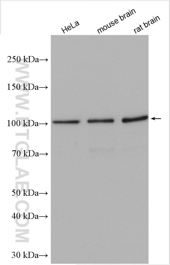 Western Blot (WB) analysis of various lysates using HGS Polyclonal antibody (10390-1-AP)