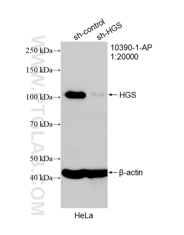 Western Blot (WB) analysis of HeLa cells using HGS Polyclonal antibody (10390-1-AP)
