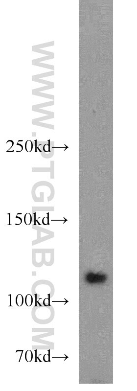 WB analysis of HeLa using 10390-1-AP