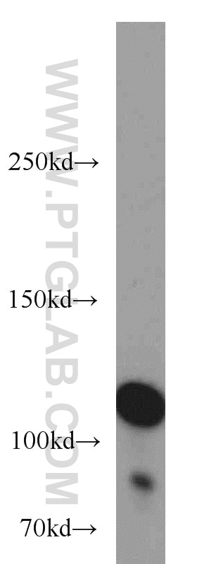 Western Blot (WB) analysis of K-562 cells using HGS Polyclonal antibody (10390-1-AP)