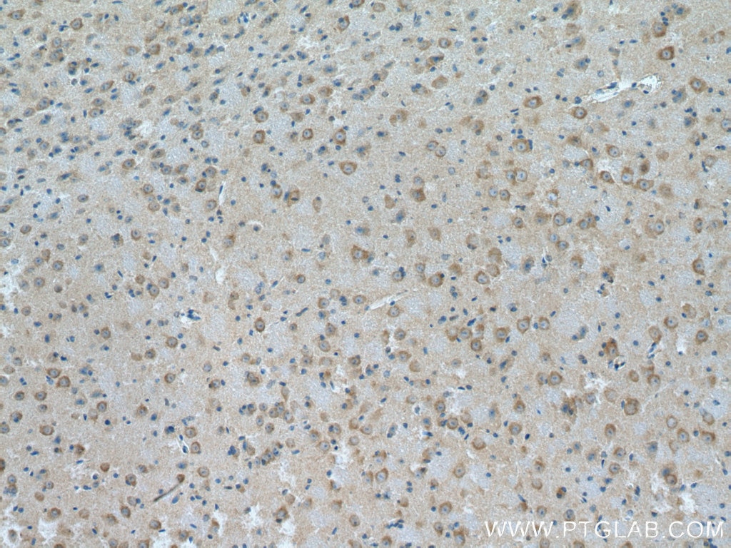 Immunohistochemistry (IHC) staining of mouse brain tissue using HGS Monoclonal antibody (67818-1-Ig)