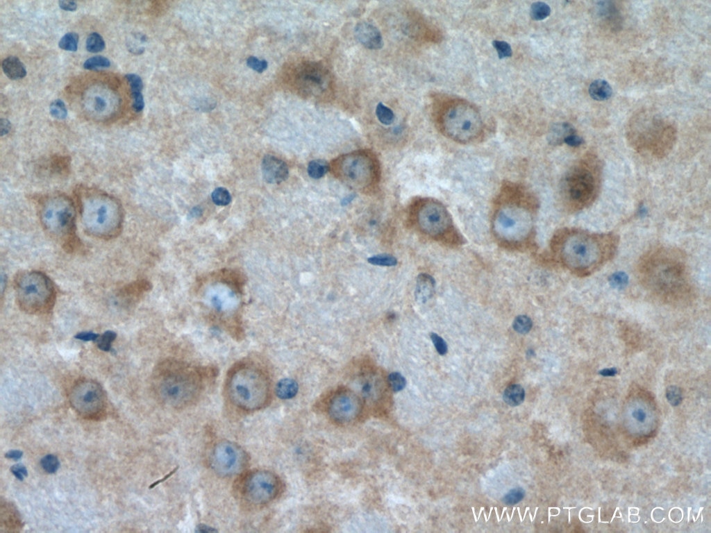 Immunohistochemistry (IHC) staining of mouse brain tissue using HGS Monoclonal antibody (67818-1-Ig)
