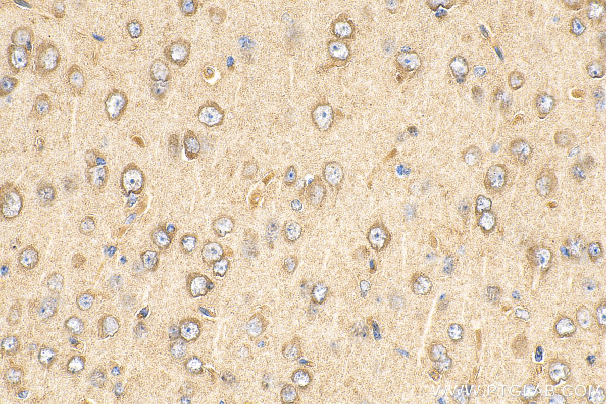 Immunohistochemistry (IHC) staining of mouse brain tissue using HGS Monoclonal antibody (67818-1-Ig)