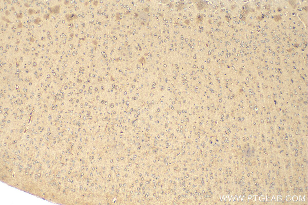 Immunohistochemistry (IHC) staining of mouse brain tissue using HGS Monoclonal antibody (67818-1-Ig)