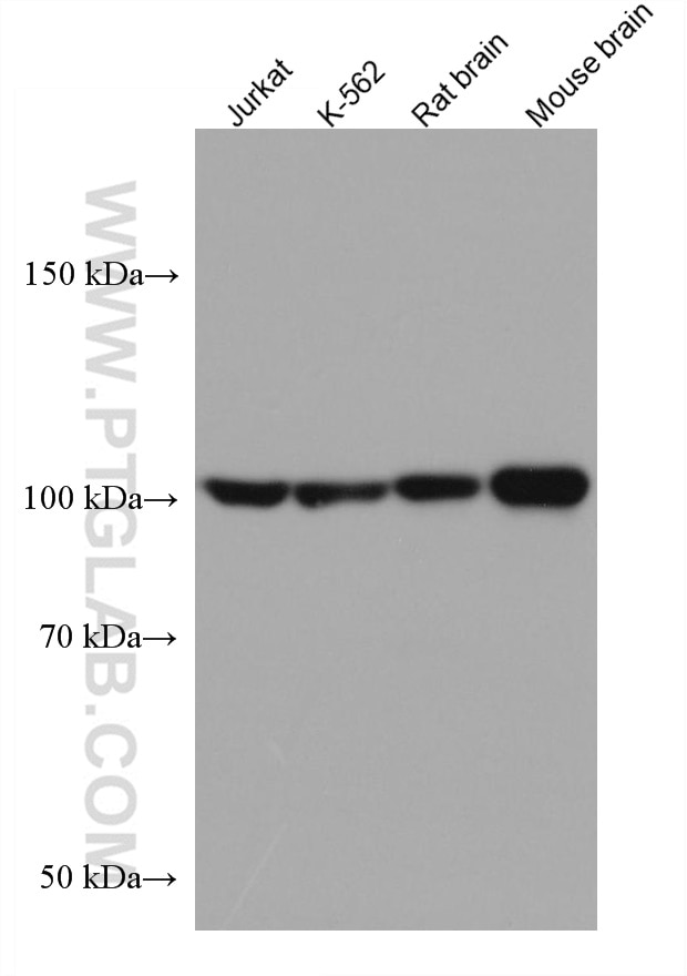 Western Blot (WB) analysis of various lysates using HGS Monoclonal antibody (67818-1-Ig)