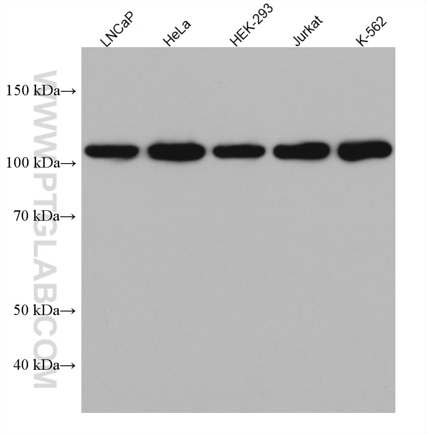 Western Blot (WB) analysis of various lysates using HGS Monoclonal antibody (67818-1-Ig)