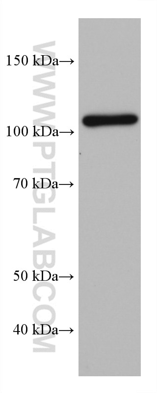 Western Blot (WB) analysis of Neuro-2a cells using HGS Monoclonal antibody (67818-1-Ig)