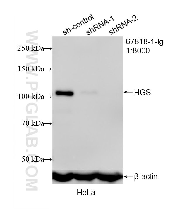 Western Blot (WB) analysis of HeLa cells using HGS Monoclonal antibody (67818-1-Ig)