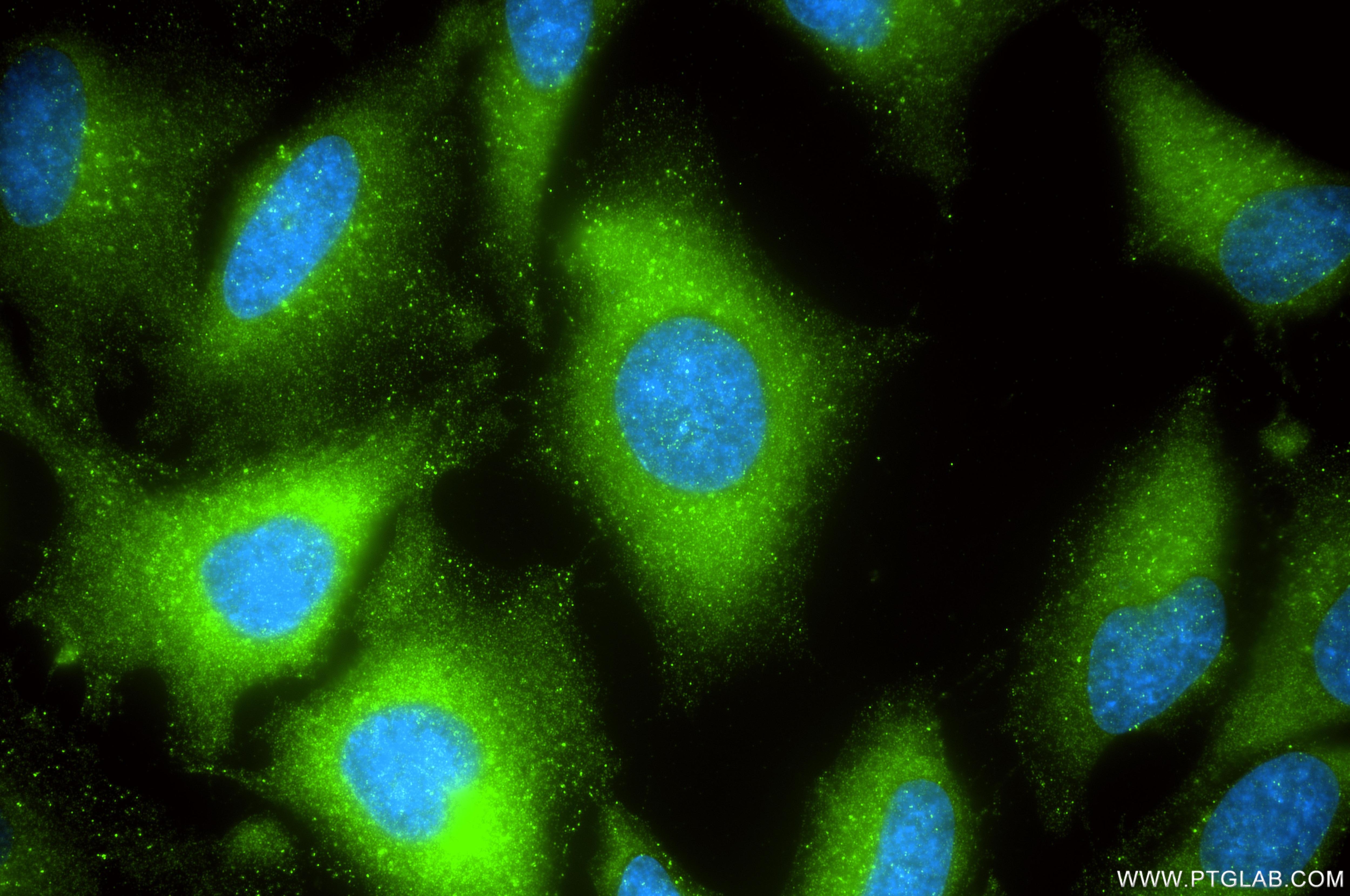 IF Staining of HeLa using 87420-1-RR (same clone as 87420-1-PBS) Immunofluorescence (IF) / fluorescent staining of HeLa cells using HGS Recombinant monoclonal antibody (87420-1-RR)