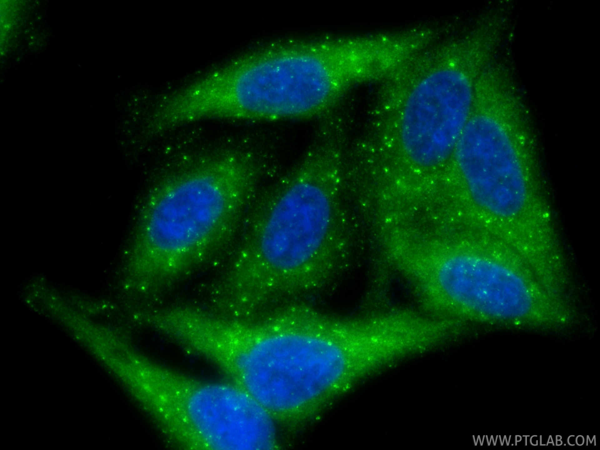 IF Staining of HepG2 using 87420-1-RR (same clone as 87420-1-PBS) Immunofluorescence (IF) / fluorescent staining of HepG2 cells using HGS Recombinant monoclonal antibody (87420-1-RR)
