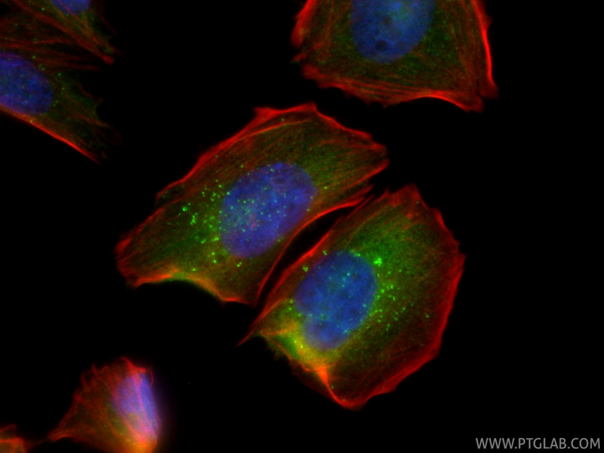 IF Staining of Saos-2 using 87420-1-RR (same clone as 87420-1-PBS) Immunofluorescence (IF) / fluorescent staining of Saos-2 cells using HGS Recombinant monoclonal antibody (87420-1-RR)