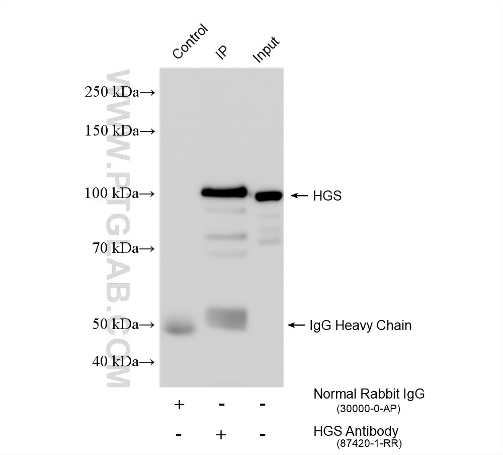 IP experiment of mouse brain using 87420-1-RR (same clone as 87420-1-PBS) Immunoprecipitation (IP) experiment of mouse brain tissue using HGS Recombinant monoclonal antibody (87420-1-RR)
