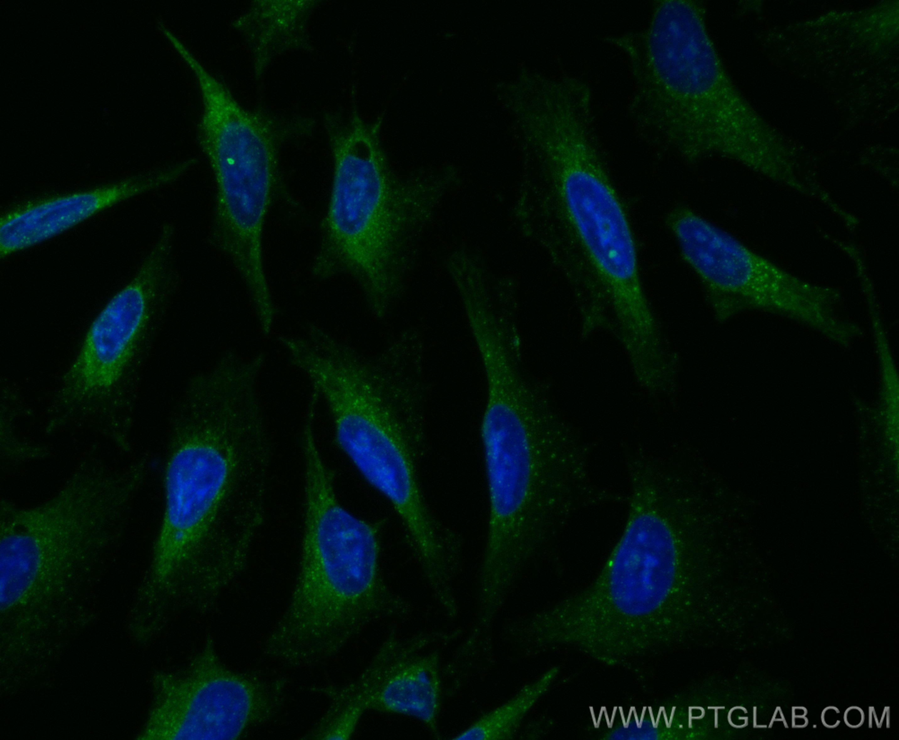 Immunofluorescence (IF) / fluorescent staining of HeLa cells using CoraLite® Plus 488-conjugated HGS Polyclonal antib (CL488-10390)