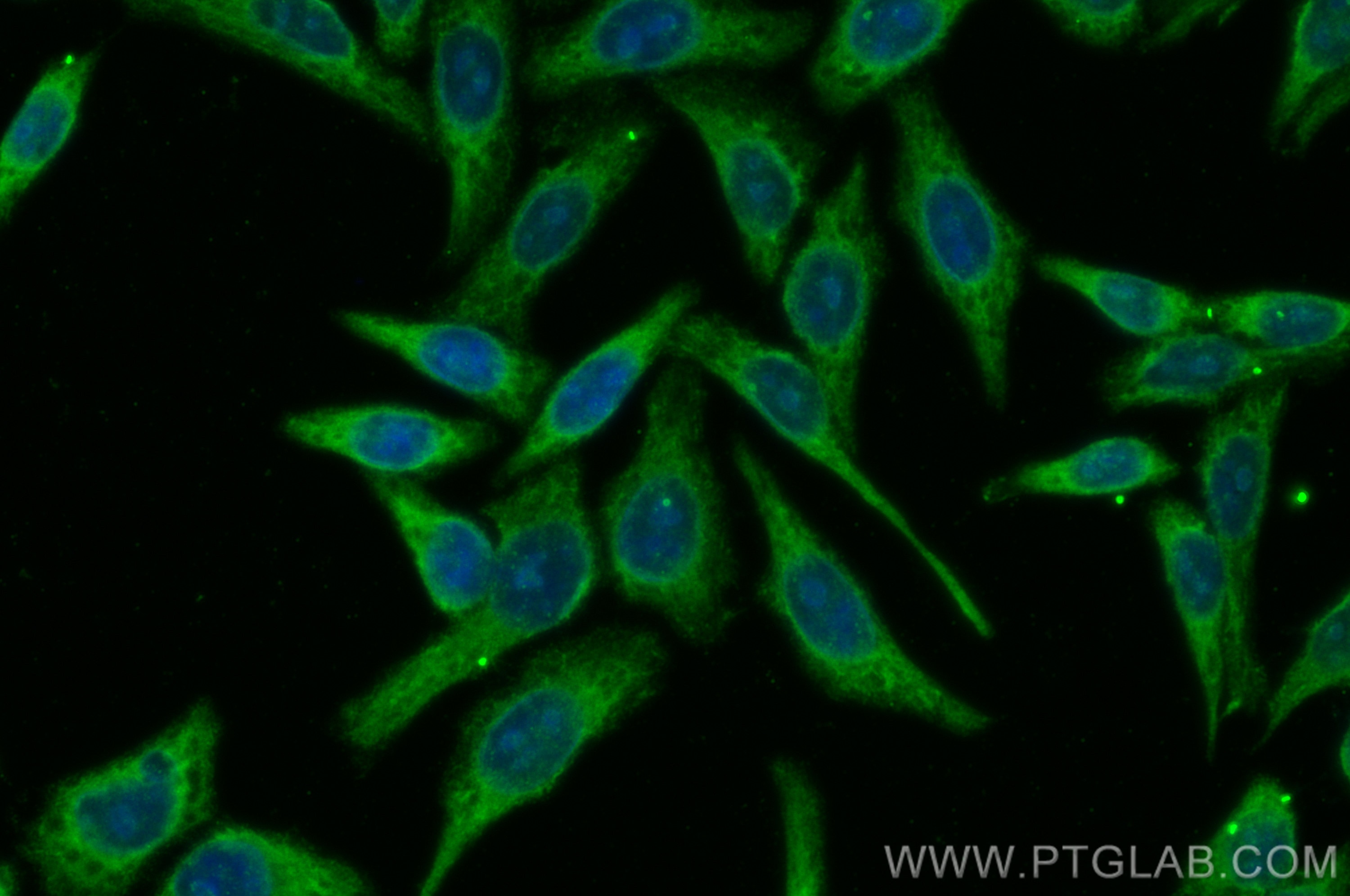 IF Staining of HepG2 using CL488-67818