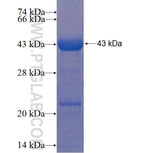 HGS fusion protein Ag22820 SDS-PAGE