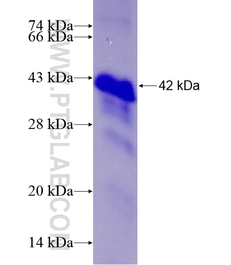 HGS fusion protein Ag28610 SDS-PAGE