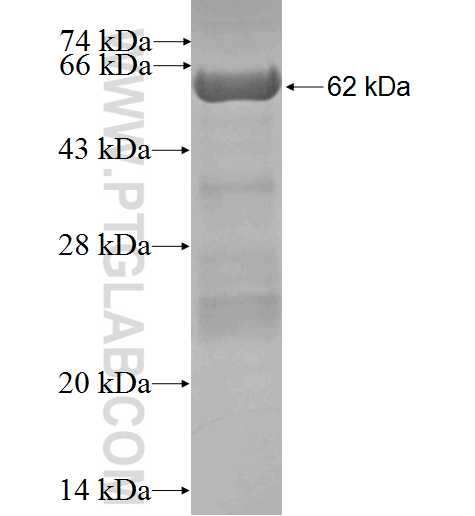 HGS fusion protein Ag0589 SDS-PAGE