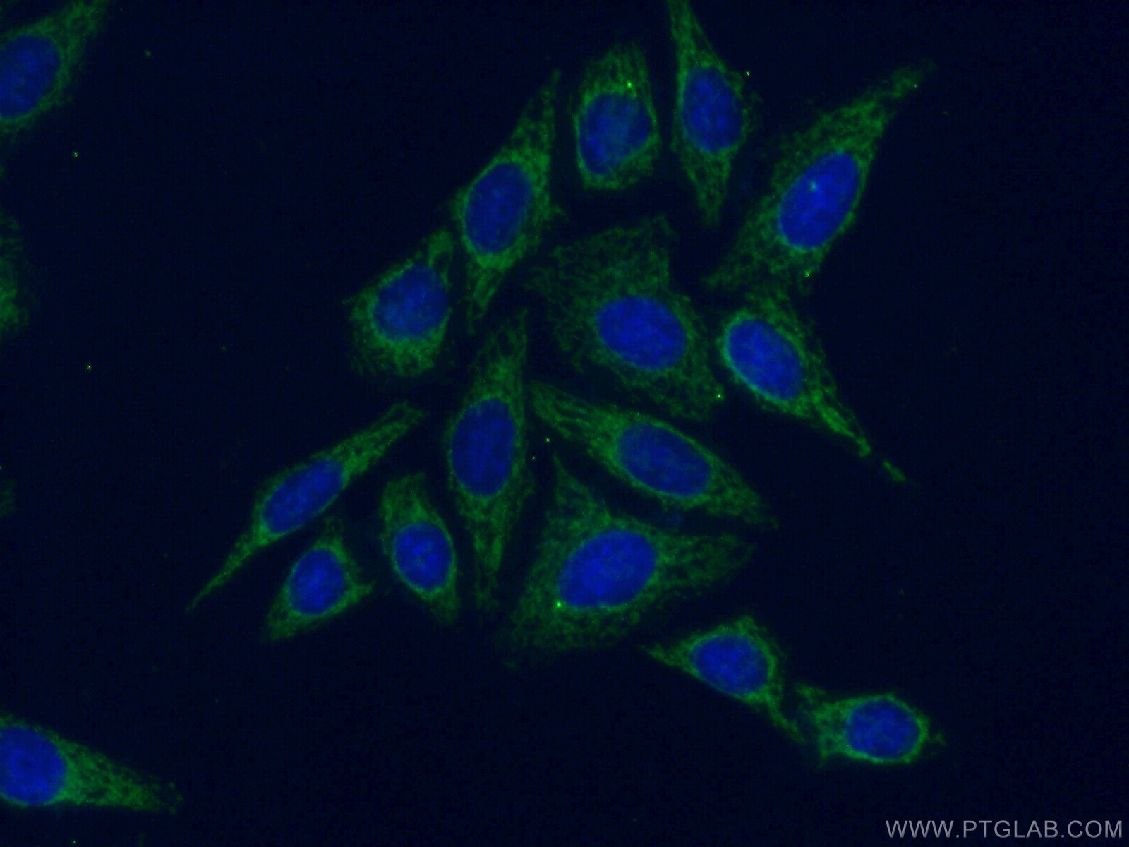 Immunofluorescence (IF) / fluorescent staining of HepG2 cells using HGSNAT Polyclonal antibody (12399-1-AP)