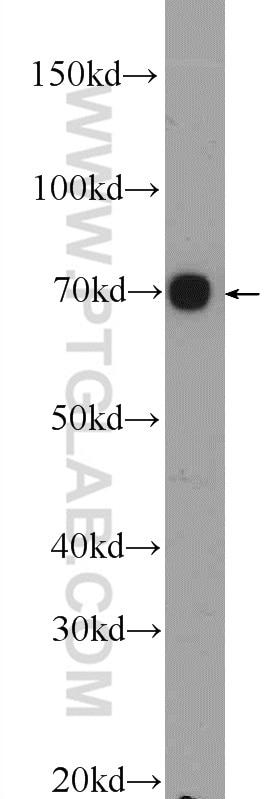 Western Blot (WB) analysis of mouse liver tissue using HGSNAT Polyclonal antibody (12399-1-AP)