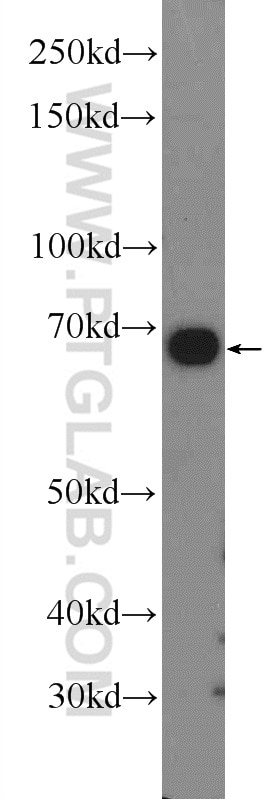 Western Blot (WB) analysis of mouse liver tissue using HGSNAT Polyclonal antibody (12399-1-AP)