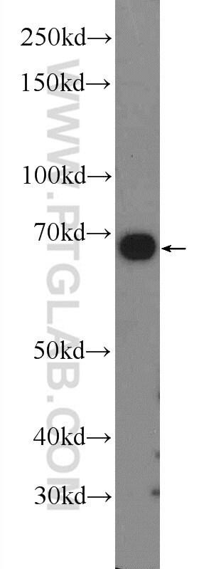 WB analysis of mouse liver using 12399-1-AP