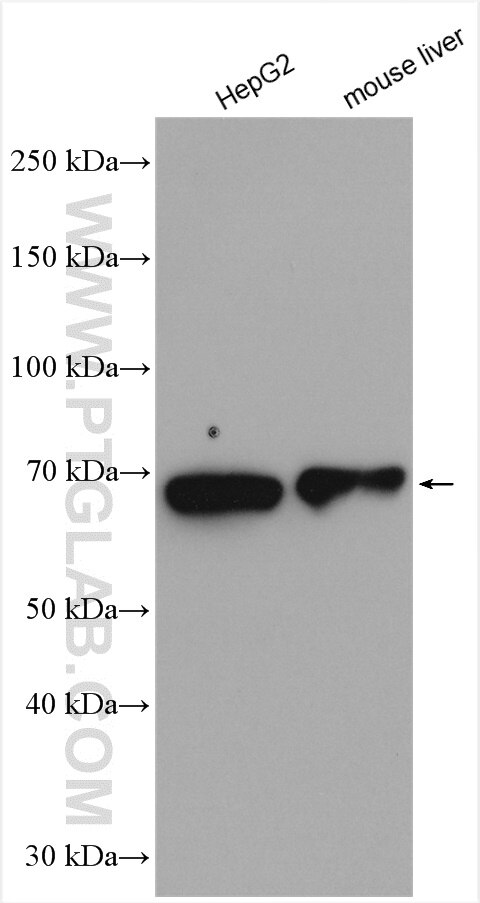 Western Blot (WB) analysis of various lysates using HGSNAT Polyclonal antibody (12399-1-AP)