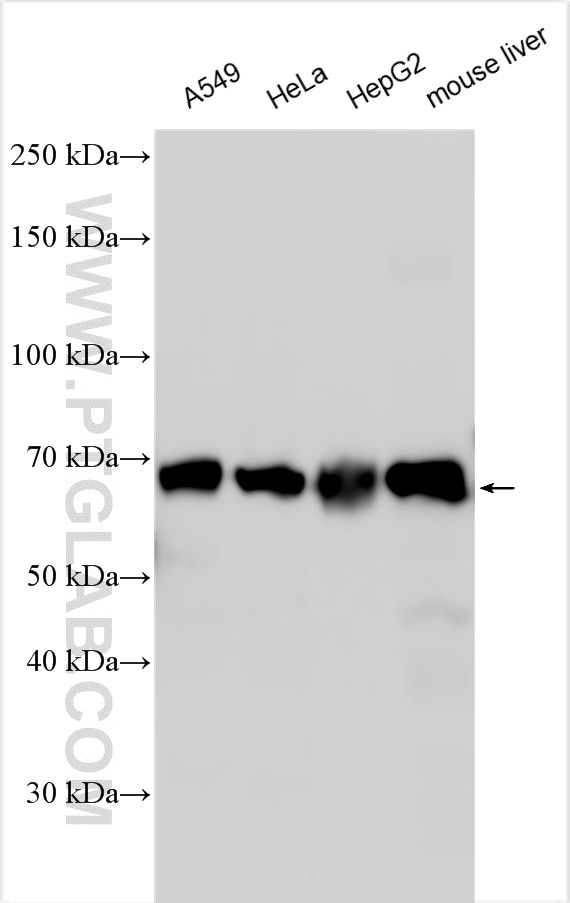 Western Blot (WB) analysis of various lysates using HGSNAT Polyclonal antibody (12399-1-AP)